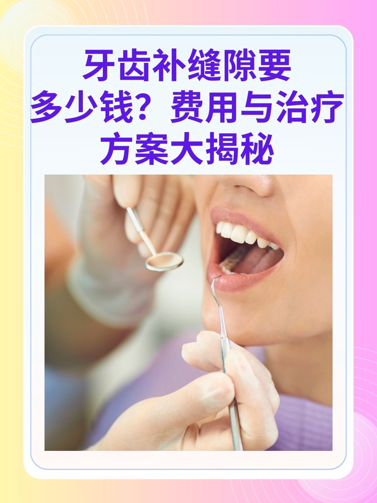 秦皇岛补牙医保可以报销吗(补牙医保可以报销吗 哪些可以报销呢)